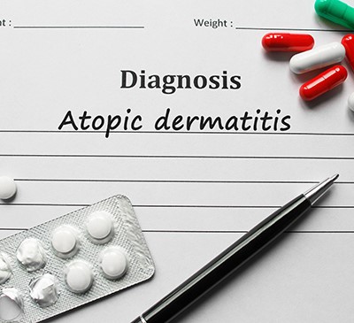 Atopic Dermatitis - A Pipeline Analysis Report